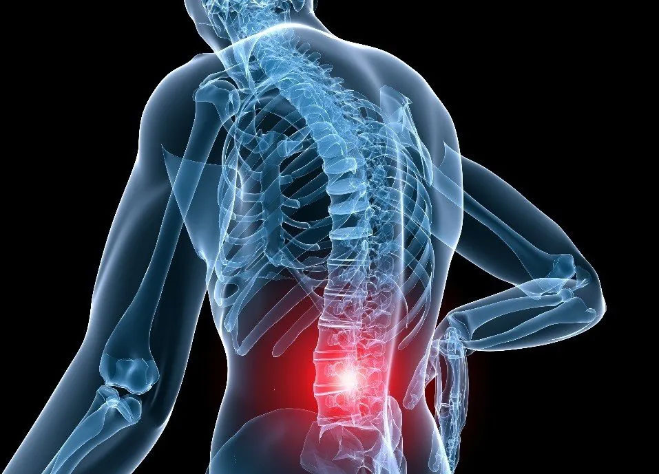Sciatica Treatment